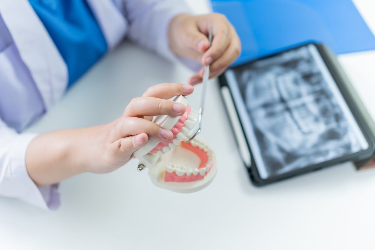 co zamiast implantu zęba